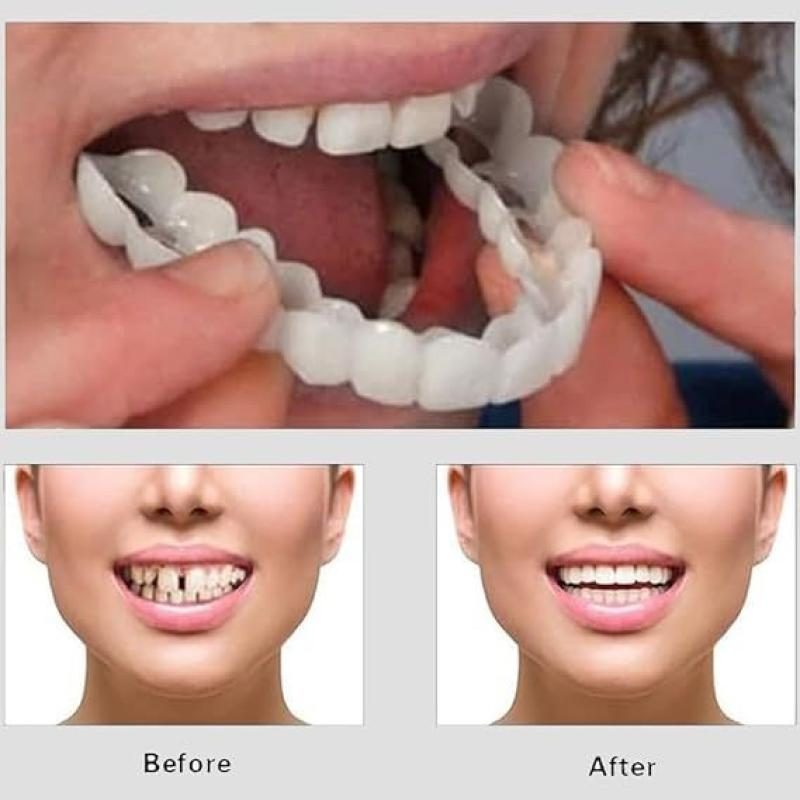 Snap On Smile Veneers Teeth For Men And Women Moldable False Artificial Braces Teeth Kits
