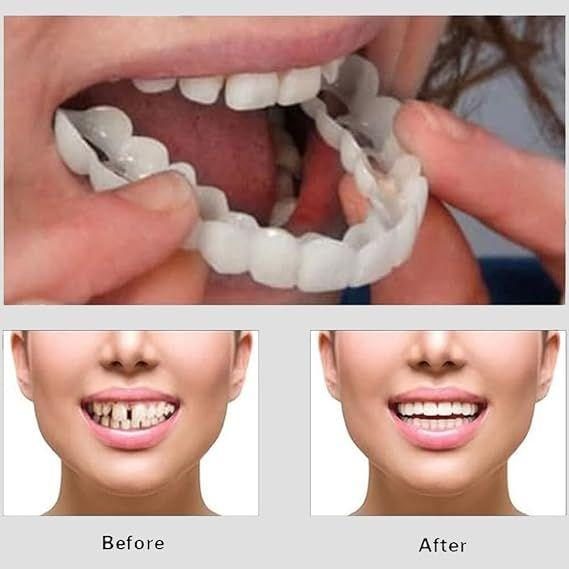 Snap On Smile Veneers Teeth For Men And Women Moldable False Artificial Braces Teeth Kits